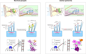 The disease-causing mechanism of the Usher syndrome